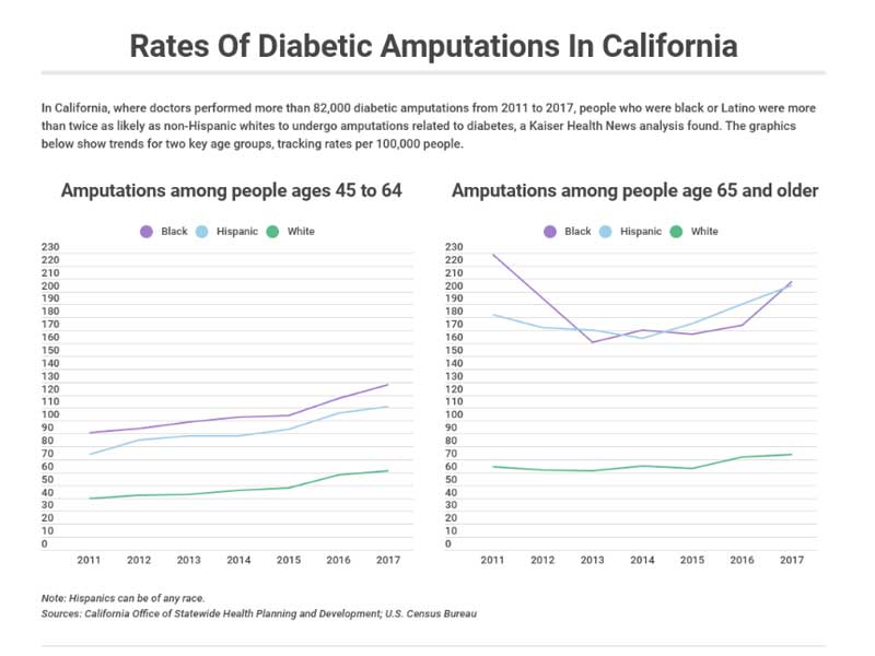 Rates of diabetes amputations in California